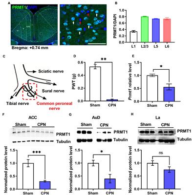 Cingulate protein arginine methyltransferases 1 regulates peripheral hypersensitivity via fragile X messenger ribonucleoprotein